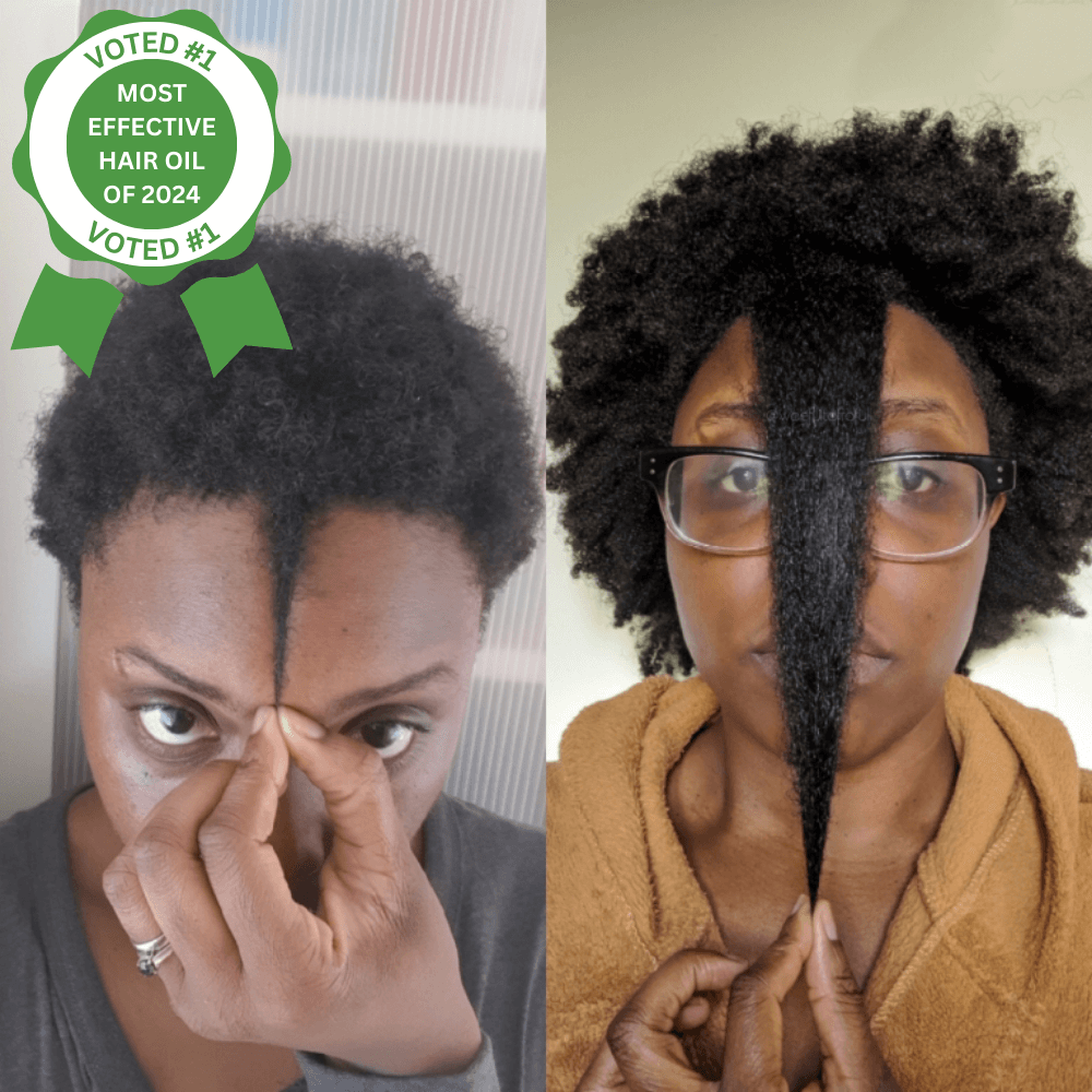 10-in-1 Chebe Oil Helps Your Hair Grow Naturally